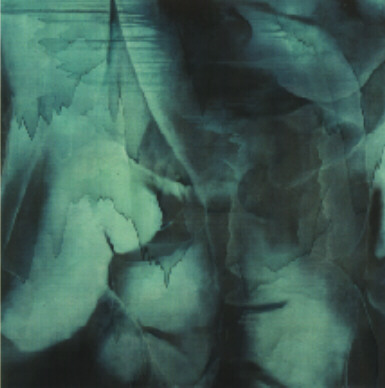 Barium Enema of 1994